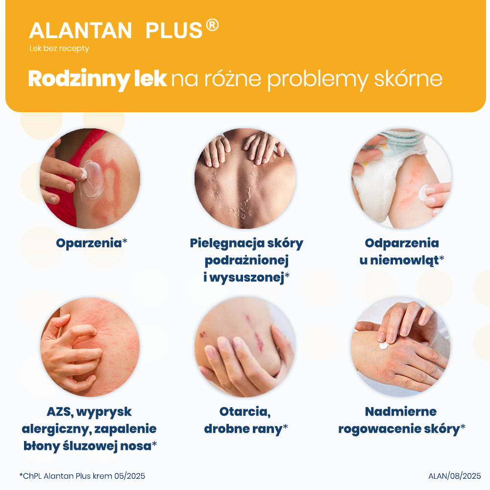 Alantan Plus (20 mg + 50 mg)/g krem, 35 g