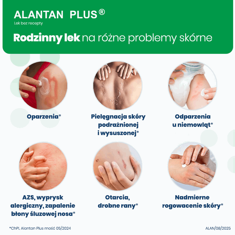Alantan Plus (20 mg + 50 mg)/g maść, 30 g