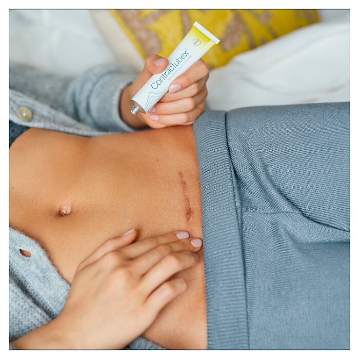 Contractubex żel 20 g