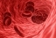 Anemia – przyczyny, objawy, leczenie. Jakie leki na niedobór żelaza?