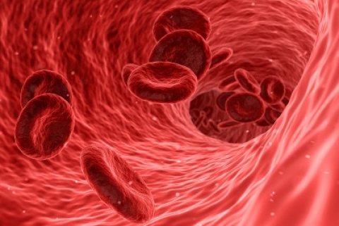Anemia – przyczyny, objawy, leczenie. Jakie leki na niedobór żelaza?