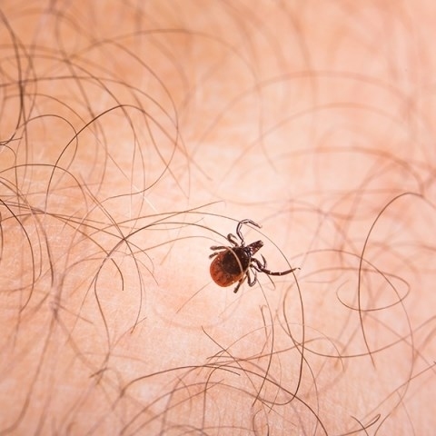 Borelioza – objawy, badanie, leczenie. Jakie są skutki nieleczonej boreliozy?