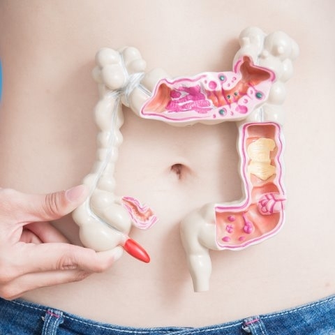 Rak jelita grubego - objawy, przyczyny, jakie są rokowania?