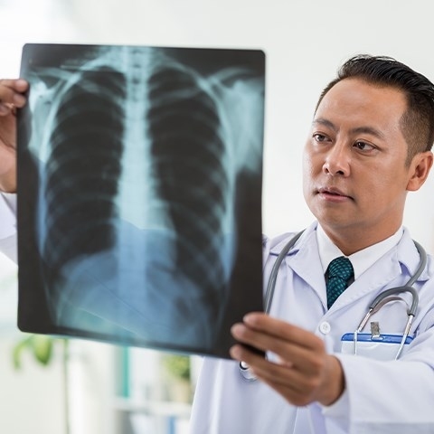 Zapalenie oskrzeli – objawy, leczenie i powikłania po chorobie