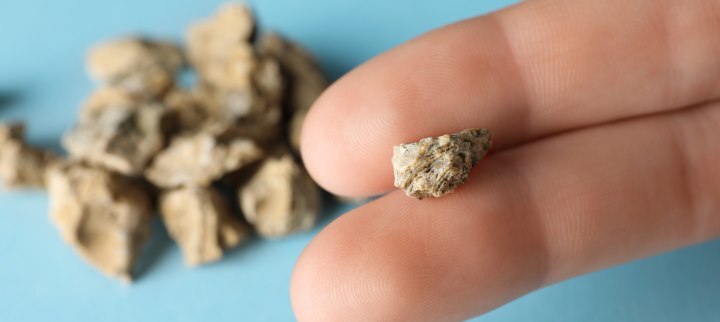 Kamica nerkowa - jak się objawia? Pierwsza pomoc podczas ataku kolki nerkowej