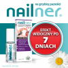 Nailner lakier 2w1 5 ml