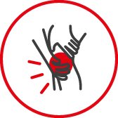 Skręcenia
