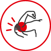 Stłuczenia