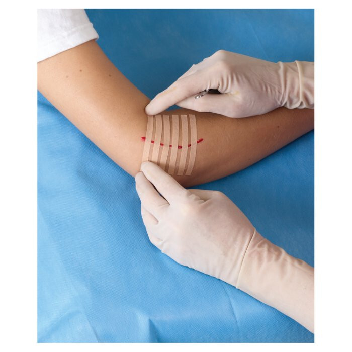 STERI-STRIP Paski do zamykania ran 6 pasków o rozmiarach (6mm x 75mm)