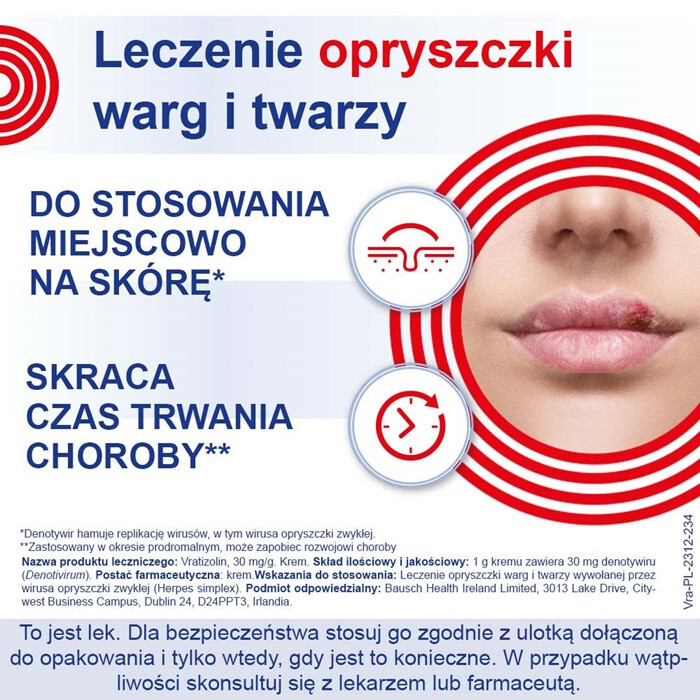 Vratizolin 3% krem 3 g