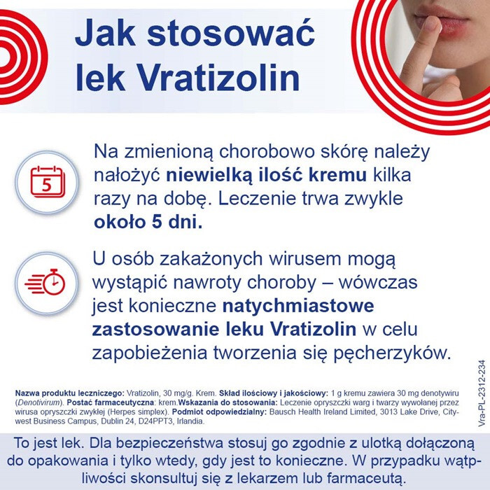 Vratizolin 3% krem 3 g
