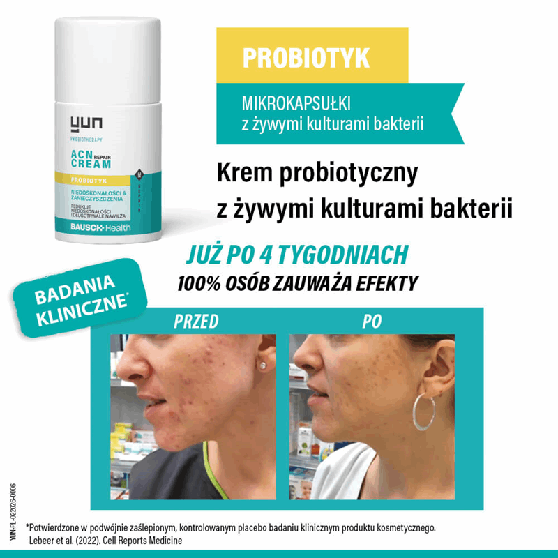Yun ACN Repair Cream krem probiotyczny do twarzy, 50 ml